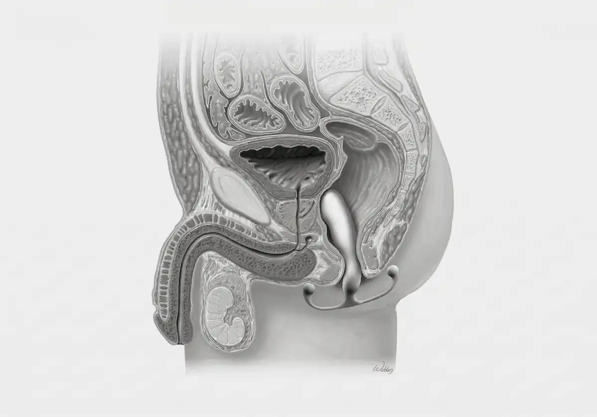 Aneros Introduces Soaker for Enhanced Prostate Massager Cleaning